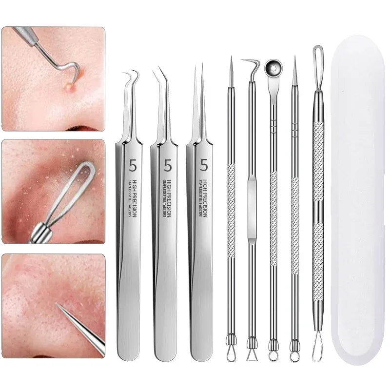 Professional Blackhead Clip Pimples Tweezer Set – 3 to 8 Pieces for Acne & Comedone Extraction